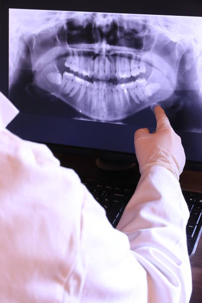 Best Emergency TMJ Treatment in Yucos, CA