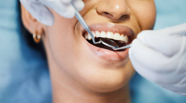 Best Emergency Dental Care for Broken or Chipped Teeth in Yucos, CA